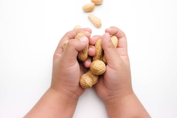 Alergia a los cacahuetes en bebés
